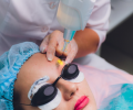 Có nên xóa xăm chân mày bằng laser