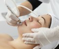 Điều trị các vấn đề về da bằng laser pico