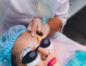 Có nên xóa xăm chân mày bằng laser